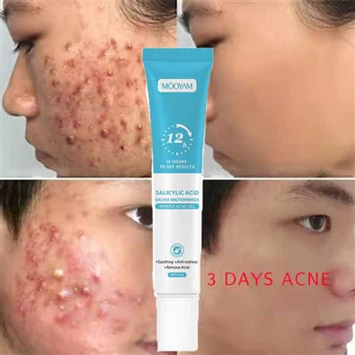 Поправете белег от пъпка анти сметана